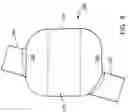 Fig. 08 - Balloon cuff tracheostomy tube