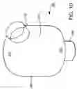 Fig. 09 - Balloon cuff tracheostomy tube