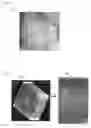 Fig. 02 - Method and system for detection of contrast injection in fluoroscopic image sequences