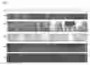 Fig. 07 - Method and system for detection of contrast injection in fluoroscopic image sequences
