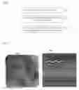 Fig. 08 - Method and system for detection of contrast injection in fluoroscopic image sequences