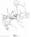 Fig. 02 - Automatic external defibrillator with enhanced clarity of audible prompts