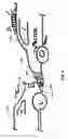 Fig. 05 - APPARATUS TO IMMOBILIZE AN INTERNAL COMBUSTION ENGINE MOTOR VEHICLE