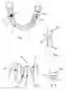 Fig. 02 - Tooth implant