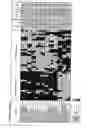 Fig. 07 - Assays, methods and systems for predicting follicular lymphoma outcome
