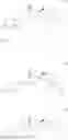 Fig. 11 - 19-NOR-PROGESTERONE FOR CONTRACEPTION