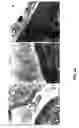 Fig. 64 - Methods and compositions to inhibit edema factor and adenylyl cyclase