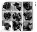 Fig. 65 - Methods and compositions to inhibit edema factor and adenylyl cyclase