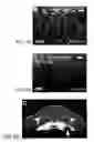 Fig. 09 - REMOTELY TRIGGERED RELEASE FROM HEATABLE SURFACES