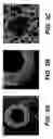 Fig. 05 - Bio-polymer and scaffold-sheet method for tissue engineering