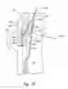 Fig. 07 - Systems and methods for transeptal cardiac procedures, including tissue penetrating members and associated methods