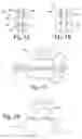 Fig. 02 - DEVICES AND METHODS FOR MINIMALLY-INVASIVE SURGICAL PROCEDURES