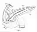 Fig. 08 - System and method for forming a stent of a desired length at an endoluminal site