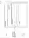 Fig. 19 - DIAGNOSIS THROUGH GRAPHICAL REPRESENTATION OF PATIENT CHARACTERISTICS