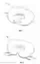 Fig. 02 - Support pillow for breastfeeding
