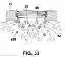 Fig. 34 - Sparkplug with precision gap