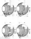 Fig. 07 - Enhancement of visual perception IV