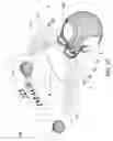 Fig. 08 - Enhancement of visual perception IV
