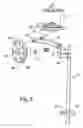 Fig. 06 - Binocular indirect ophthalmoscope