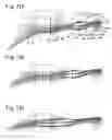 Fig. 72 - Zoom lens and electronic imaging device having the same