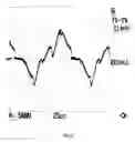 Fig. 07 - HIGH-FREQUENCY POWER SUPPLY