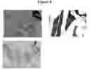 Fig. 09 - Cytotoxicity mediation of cells evidencing surface expression of MCSP