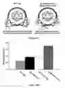 Fig. 22 - Herpes simplex virus combined subunit vaccines and methods of use thereof