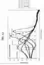Fig. 13 - Probes and methods for hepatitis C virus typing using single probe analysis