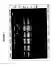 Fig. 05 - Full Karyotype Single Cell Chromosome Analysis