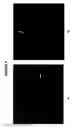 Fig. 10 - Full Karyotype Single Cell Chromosome Analysis