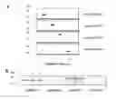 Fig. 01 - Method for subgroup analysis in subjects having or being suspected of having inflammatory disease, use of anti-p38MAPK antibodies, kits and their use