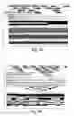 Fig. 11 - Prognostic and diagnostic method for disease therapy