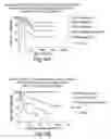 Fig. 17 - Prognostic and diagnostic method for disease therapy