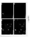 Fig. 42 - Prognostic and diagnostic method for disease therapy