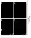 Fig. 43 - Prognostic and diagnostic method for disease therapy