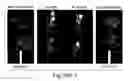 Fig. 59 - Prognostic and diagnostic method for disease therapy
