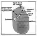 Fig. 01 - IN VITRO ASSAY FOR IDENTIFICATION OF ALLERGENIC PROTEINS