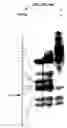 Fig. 25 - Selex and photoSELEX