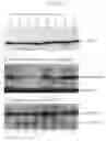 Fig. 06 - Method and composition for cancer diagnosis and treatment