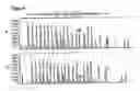 Fig. 04 - MECP2E1 gene