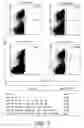 Fig. 02 - SSX-2 peptides presented by HLA class II molecules