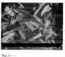 Fig. 02 - INJECTABLE DEPOT FORMULATION COMPRISING CRYSTALS OF ILOPERIDONE