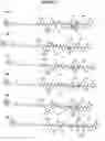 Fig. 04 - Isolation of pathogenic prions