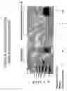 Fig. 05 - Isolation of pathogenic prions