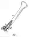 Fig. 02 - Implantable device, system for generating localised electromagnetic fields in the area of an implant and coil arrangement