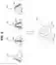 Fig. 07 - ULTRASONIC IMAGING APPARATUS AND A METHOD FOR GENERATING AN ULTRASONIC IMAGE