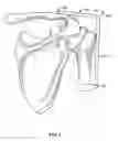 Fig. 06 - Devices, Systems and Methods for Measuring and Evaluating the Motion and Function of Joints and Associated Muscles