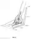 Fig. 07 - Devices, Systems and Methods for Measuring and Evaluating the Motion and Function of Joints and Associated Muscles