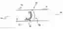 Fig. 01 - Coil Anchor Systems and Methods of Use