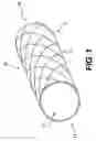 Fig. 02 - Coil Anchor Systems and Methods of Use